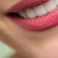 Smile Safely: The Crucial Importance Of Dental Safety In San Diego, CA