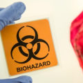 Safety Protocols for Handling Hazardous Waste in Dental Offices: A Comprehensive Guide
