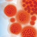 The Essentiality of Adhering to Infection Control Protocols in Dental Laboratories
