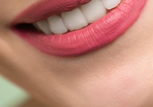 Smile Safely: The Crucial Importance Of Dental Safety In San Diego, CA