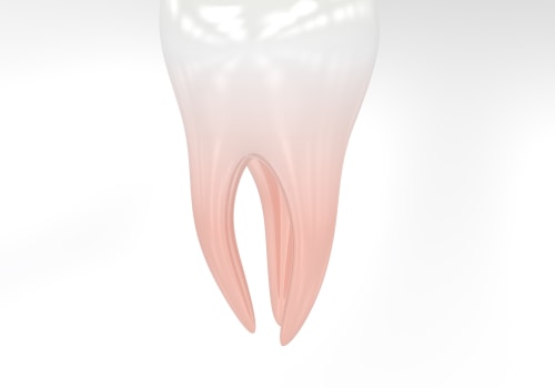 Ensuring Safety in Oral Surgery for Impacted Teeth