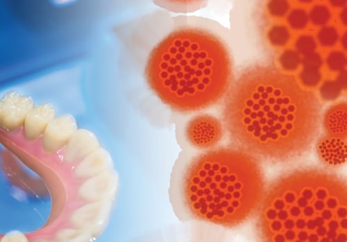 The Essentiality of Adhering to Infection Control Protocols in Dental Laboratories