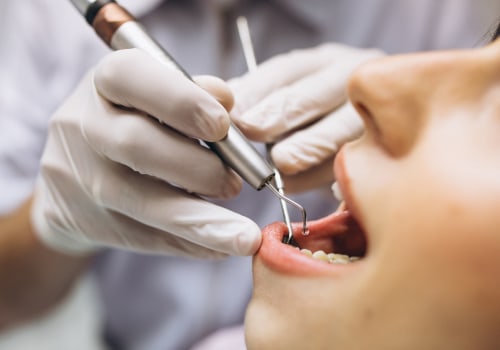Safeguarding Smiles: The Crucial Role Of Dental Safety In Vancouver